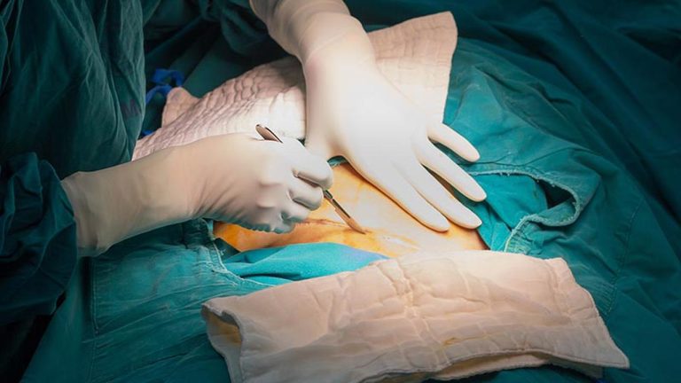 Asian doğum ameliyatı nedir? Merak edilenler ve bilinmesi gerekenler - Kapak Görseli