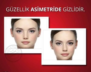 Asimetrik Göz Bozukluğu Neden Olur? Belirtileri ve Tedavi Yöntemleri - Kapak Görseli