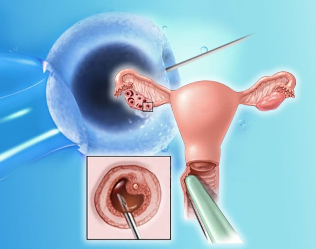 OadÖ işlemi kaç yılda bir yapılmalı? Merak edilen süre nedir? - Kapak Görseli