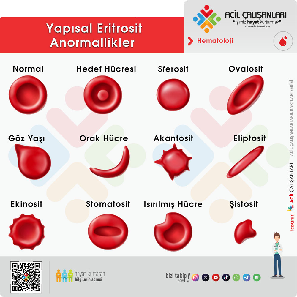 Kalıtsal Sferositozun Riskleri ve Tedavi Yöntemleri [2026 Uzman Rehberi] - Kapak Görseli